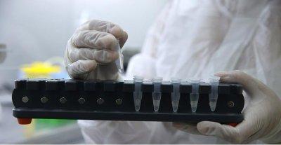 Немецкие ученые нашла доказательства лабораторного происхождения коронавируса
